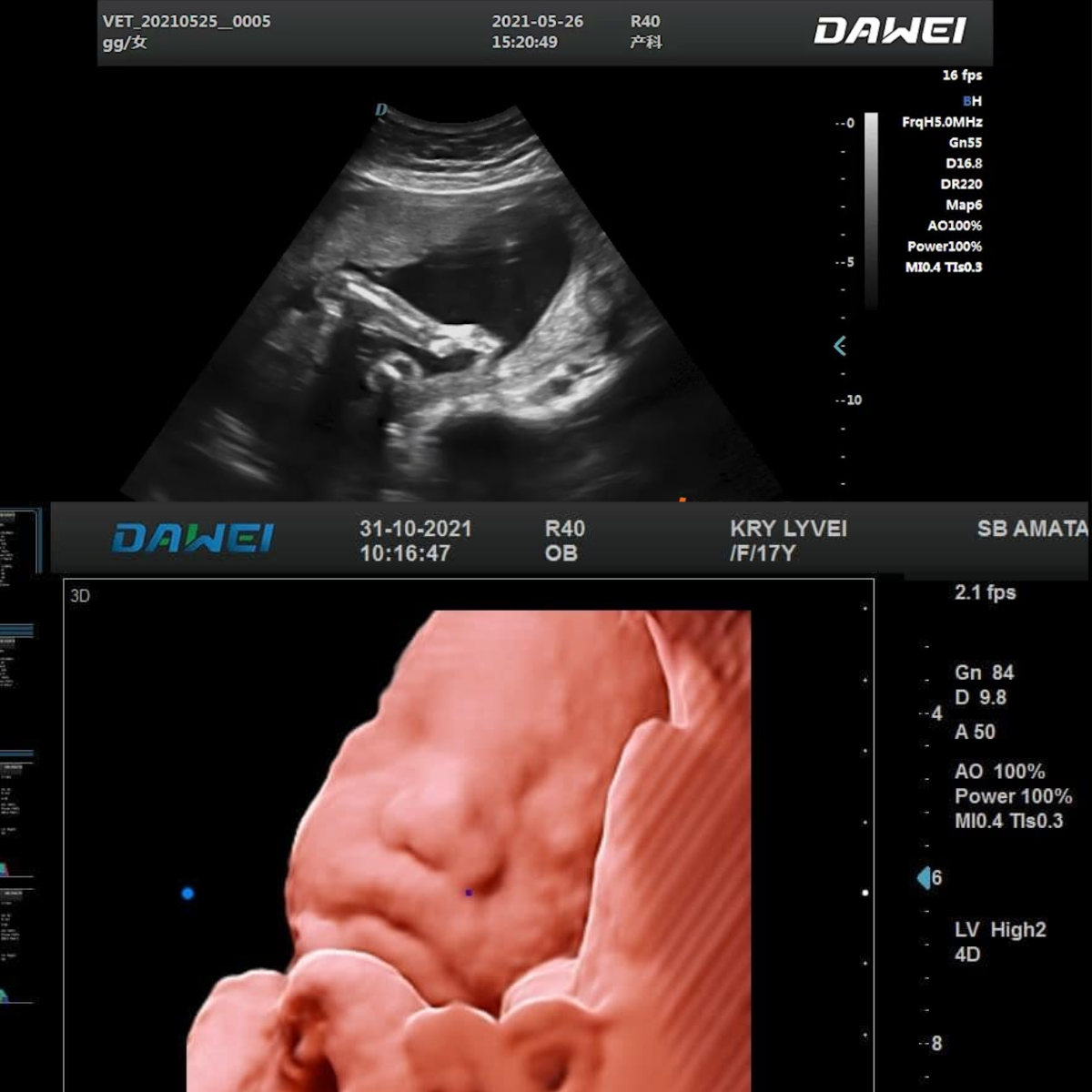 ECÓGRAFO PORTÁTIL PROFESIONAL DAWEI DW-L50 4D/5D CON DOPPLER COLOR Y ALTA RESOLUCIÓN