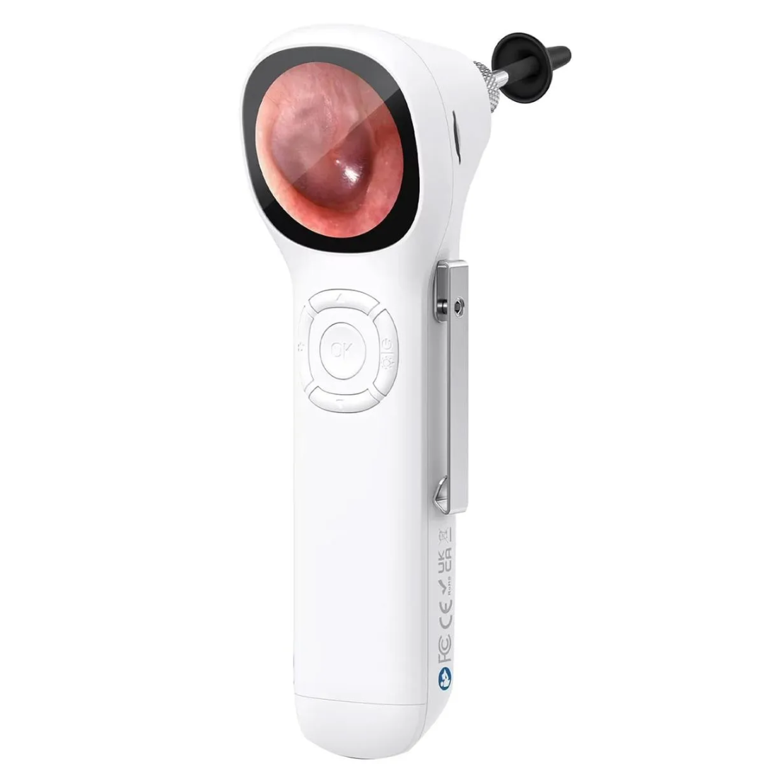 OTOSCOPIO DIGITAL CON PANTALLA IPS SA160 – EQUIPO DE DIAGNÓSTICO