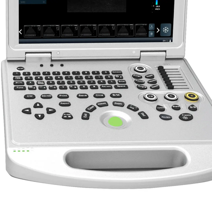 ECÓGRAFO PORTÁTIL PROFESIONAL DAWEI DW-L50 4D/5D CON DOPPLER COLOR Y ALTA RESOLUCIÓN