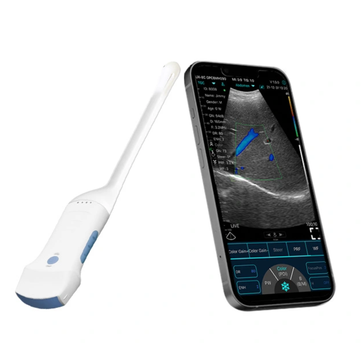 ECÓGRAFO PORTÁTIL INALÁMBRICO CONVEX GYNO PRO® PARA GINECOLOGÍA Y OBSTETRICIA