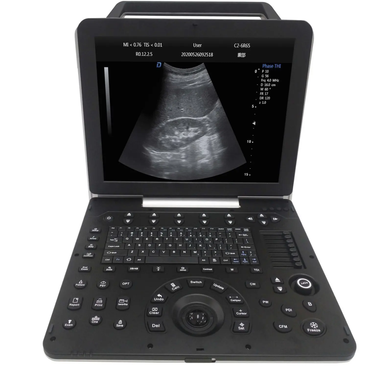 ECÓGRAFO PORTÁTIL PROFESIONAL DAWEI DW-P8 CON DOPPLER TISULAR, TDI Y STRAIN CARDÍACO