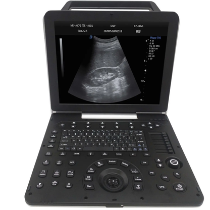 ECÓGRAFO PORTÁTIL PROFESIONAL DAWEI DW-P8 CON DOPPLER TISULAR, TDI Y STRAIN CARDÍACO