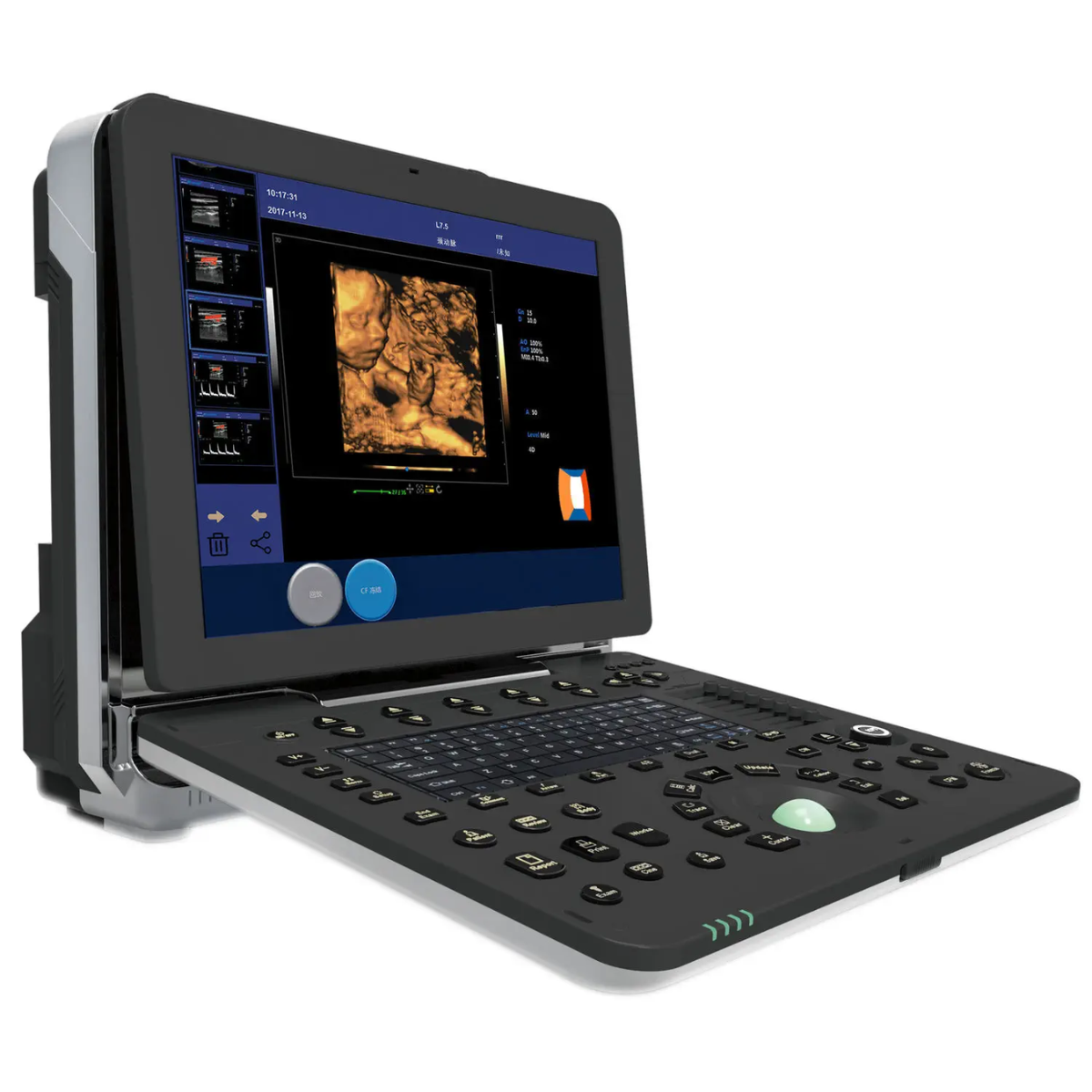 ECÓGRAFO PORTÁTIL PROFESIONAL DAWEI DW-P8 CON DOPPLER TISULAR, TDI Y STRAIN CARDÍACO