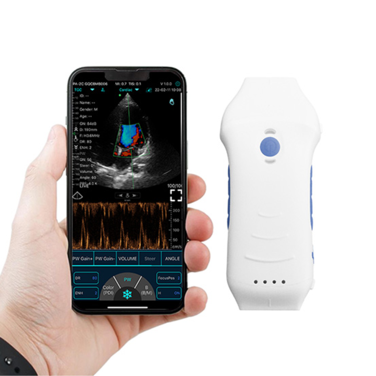 ECÓGRAFO PORTÁTIL INALÁMBRICO DUAL CARDIO PRO® | SONDA CONVEXA + CARDÍACA.