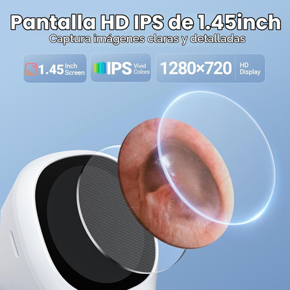 OTOSCOPIO DIGITAL CON PANTALLA IPS SA160 – EQUIPO DE DIAGNÓSTICO