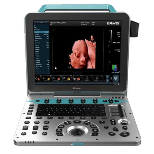 ECÓGRAFO PORTÁTIL PROFESIONAL DAWEI DW-P50 4D/5D LIVE CON DOPPLER COLOR Y ALTA RESOLUCIÓN
