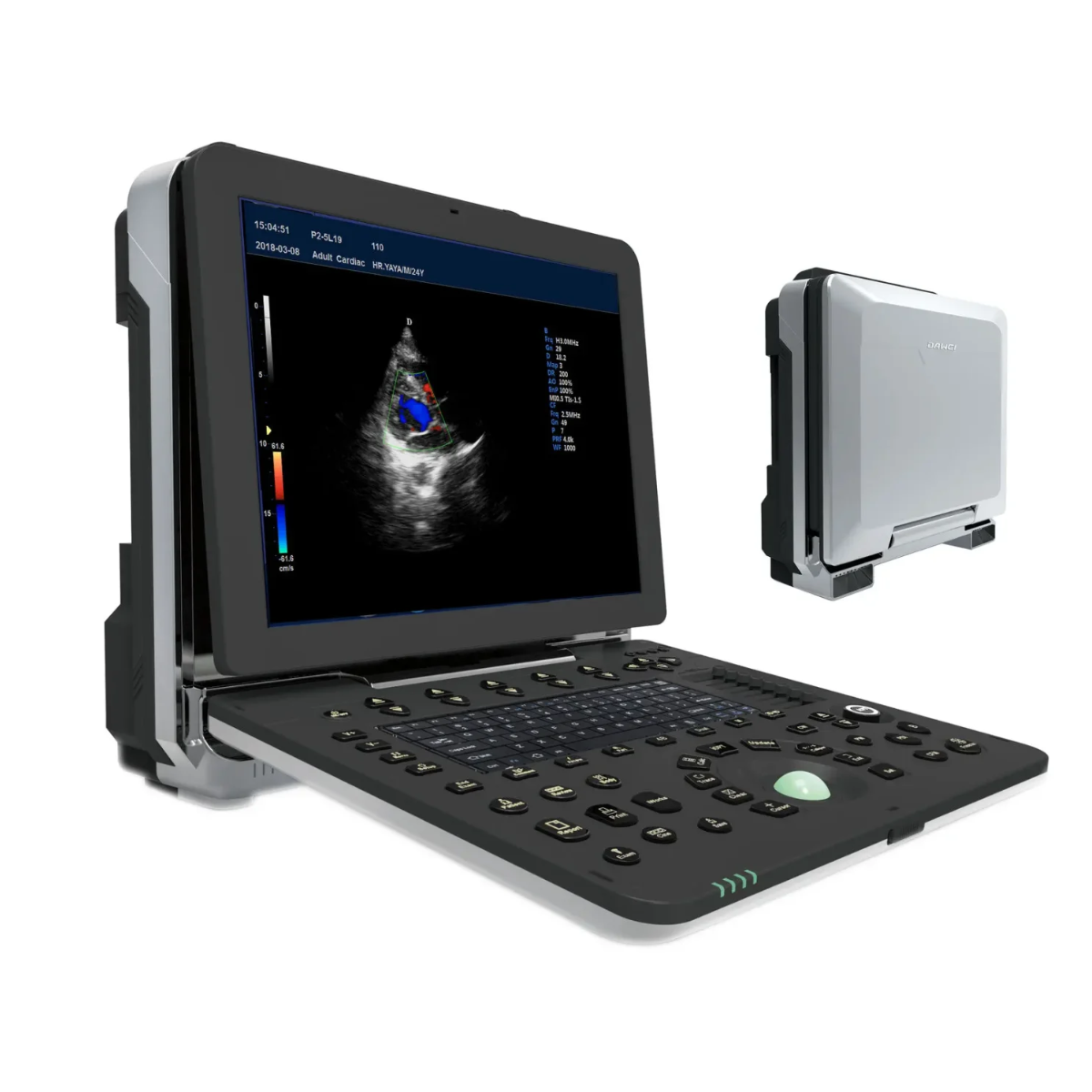 ECÓGRAFO PORTÁTIL PROFESIONAL DAWEI DW-P8 CON DOPPLER TISULAR, TDI Y STRAIN CARDÍACO