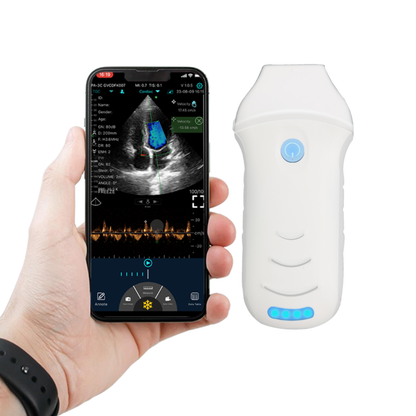 ECÓGRAFO INALÁMBRICO MAX CARDIO CW CON DOPPLER CARDÍACO PROFESIONAL
