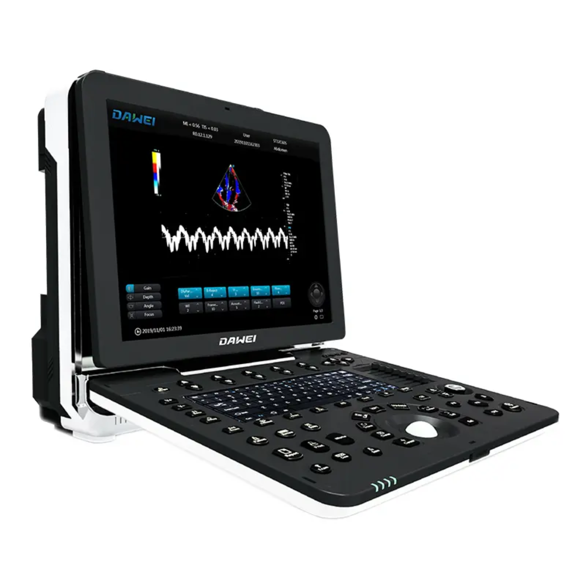 ECÓGRAFO PORTÁTIL PROFESIONAL DAWEI DW-P8 CON DOPPLER TISULAR, TDI Y STRAIN CARDÍACO