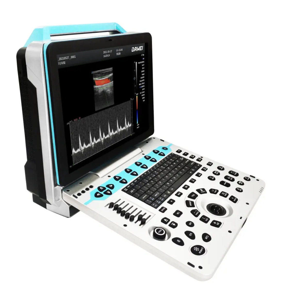 ECÓGRAFO PORTÁTIL PROFESIONAL DAWEI DW-P50 4D/5D LIVE CON DOPPLER COLOR Y ALTA RESOLUCIÓN