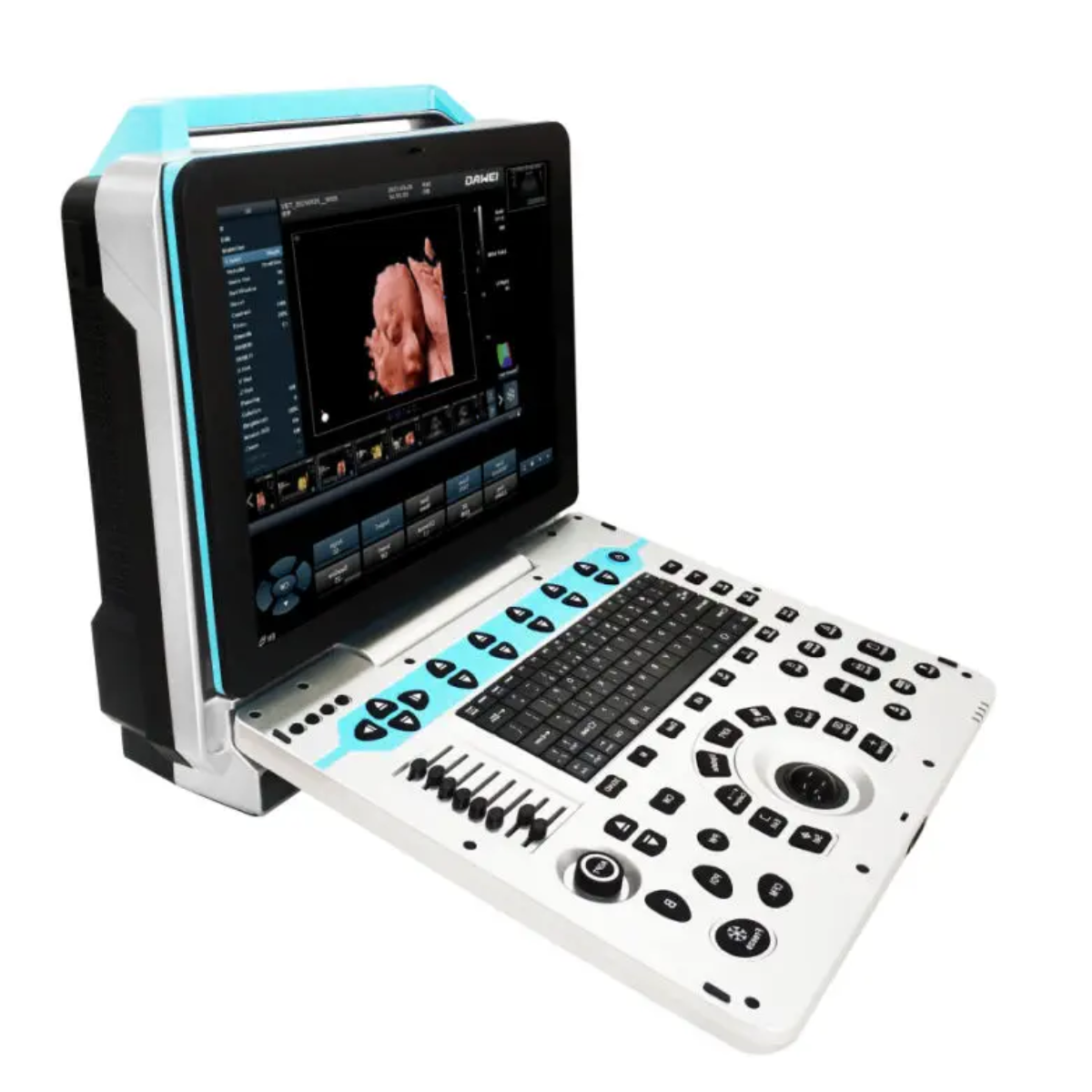 ECÓGRAFO PORTÁTIL PROFESIONAL DAWEI DW-P50 4D/5D LIVE CON DOPPLER COLOR Y ALTA RESOLUCIÓN
