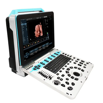 ECÓGRAFO PORTÁTIL PROFESIONAL DAWEI DW-P50 4D/5D LIVE CON DOPPLER COLOR Y ALTA RESOLUCIÓN