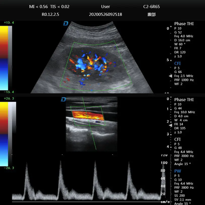 ECÓGRAFO PORTÁTIL PROFESIONAL DAWEI DW-P8 CON DOPPLER TISULAR, TDI Y STRAIN CARDÍACO